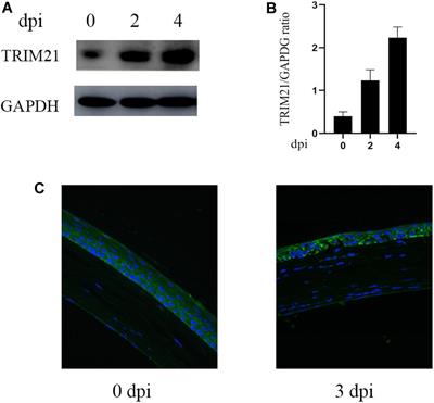 TRIM21 Aggravates Herpes Simplex Virus Epithelial Keratitis by Attenuating STING-IRF3-Mediated Type I Interferon Signaling